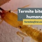termite bites on humans
