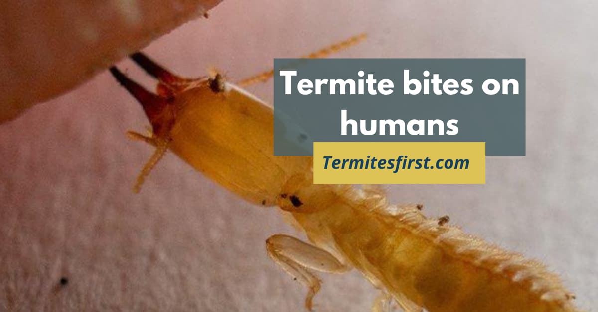 termite bites on humans